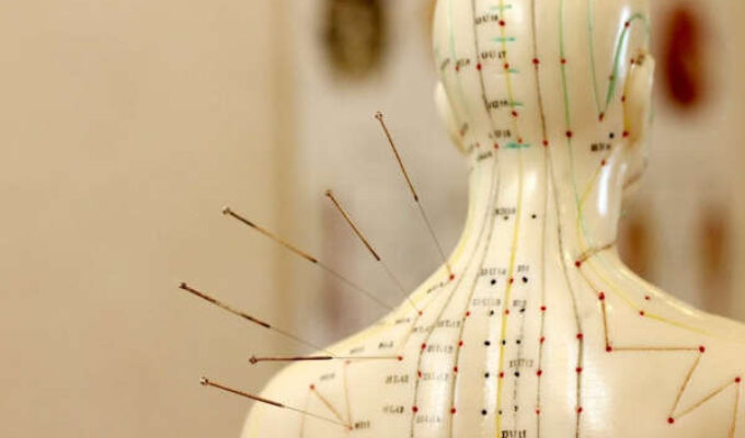 Acupuncture-Chart
