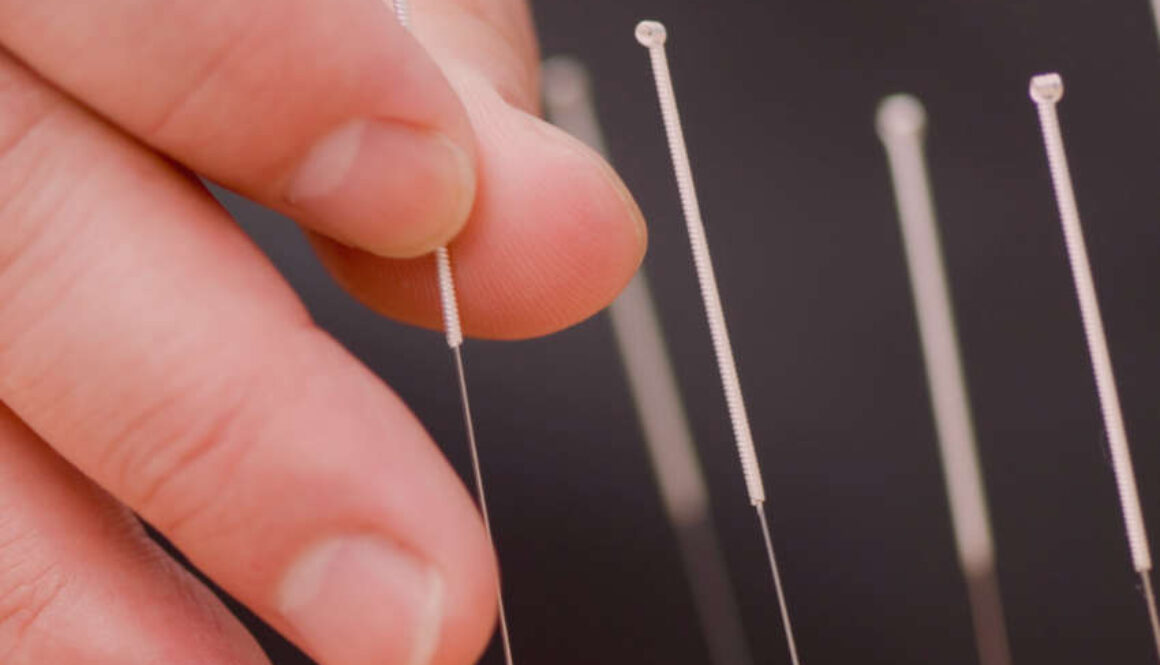 acupuncture close up